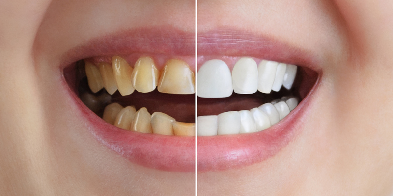 3 Options for Cosmetic Dentistry