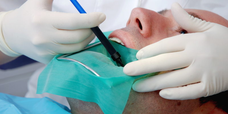 3 Signs You Might Need a Root Canal
