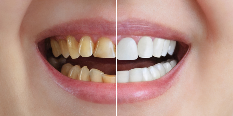 Cosmetic Dentistry Will Restore Your Beautiful Smile