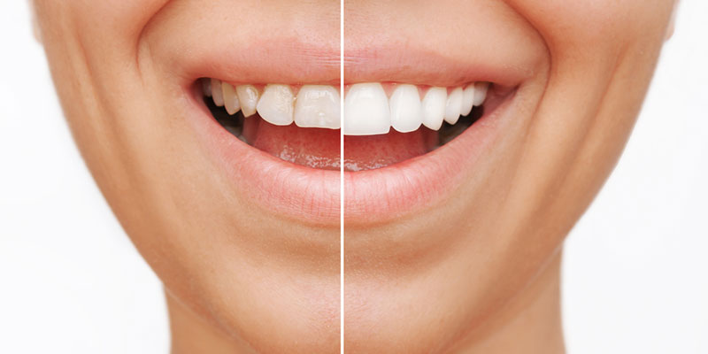 How a Cosmetic Dentist Can Transform Your Life