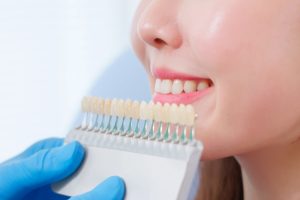 3 Things You Need to Know About Teeth Whitening